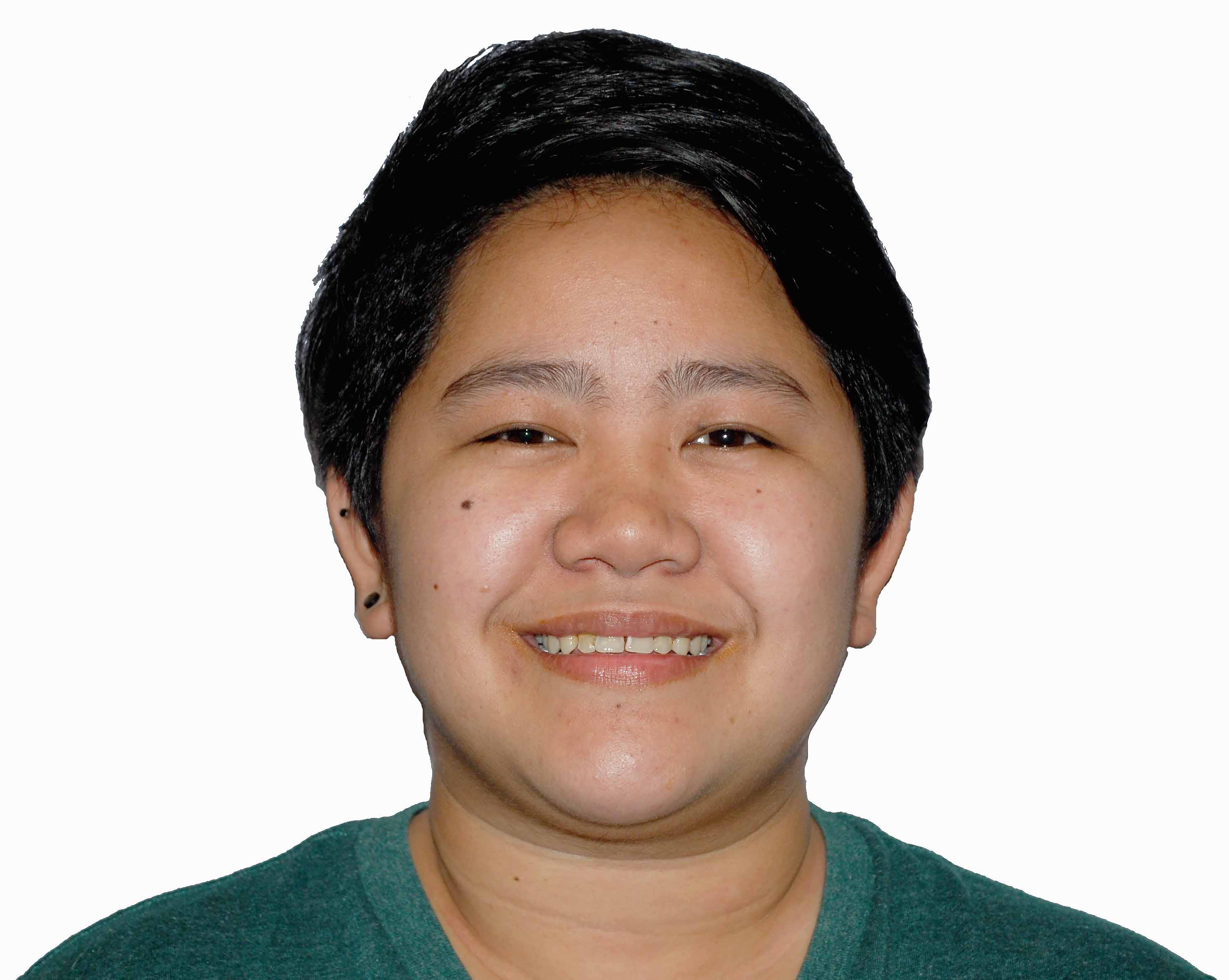 Lim, Mary Grace